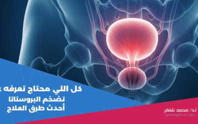 كل اللي محتاج تعرفه عن تضخم البروستاتا وأحدث طرق العلاج