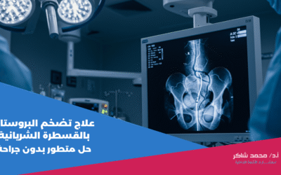 علاج تضخم البروستاتا بالقسطرة الشريانية حل متطور بدون جراحة